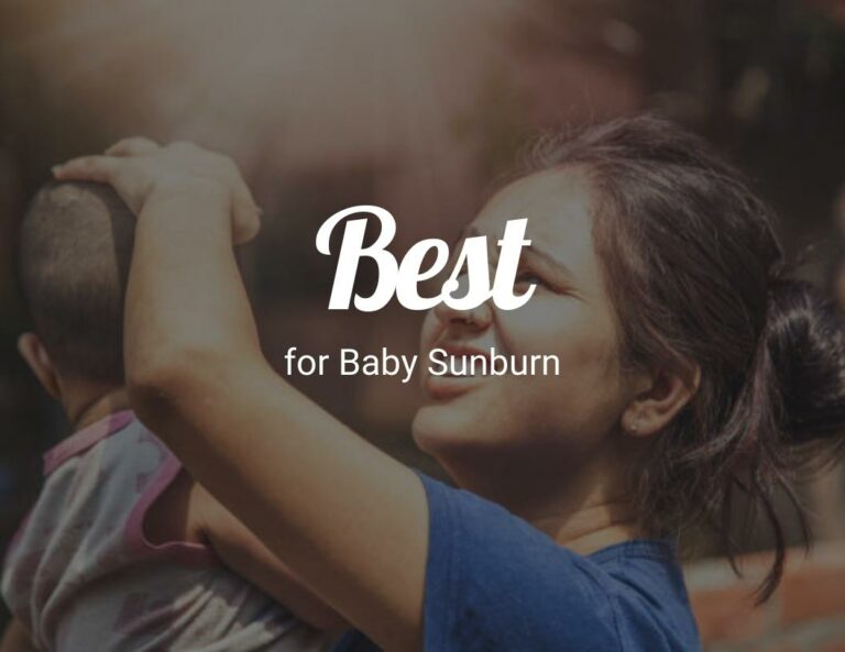 Best For Baby Sunburn? (A Mother’s Guide)